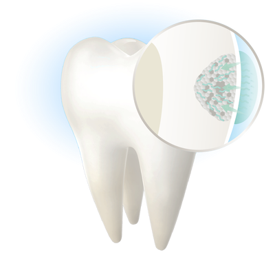 The formulation diffuses throughout the enamel.