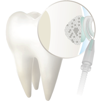 Curodont repair fluoride plus